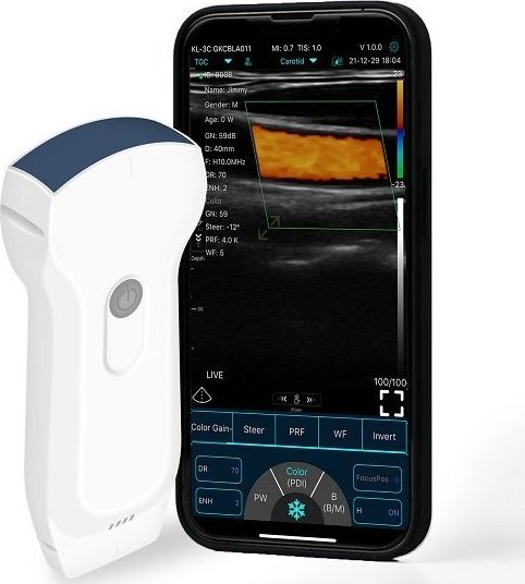 USG Dwu-głowicowy Aparat USG 3w1 + kolor doppler WIFI USB